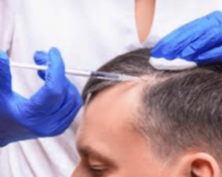 Combo plasma capilar mensual