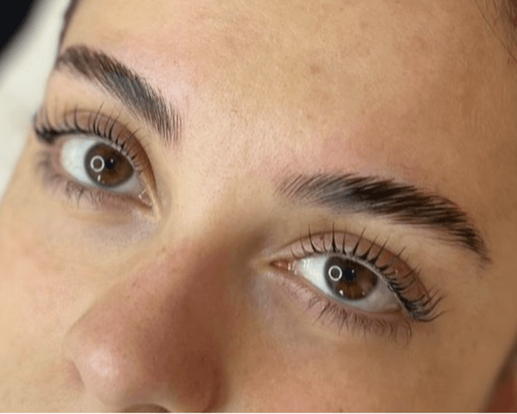 COMBO 3 - Lifting completo + laminado