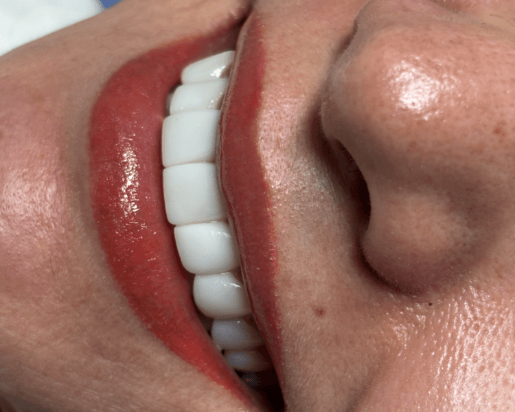 MICROPIGMENTACIÓN DE LABIOS