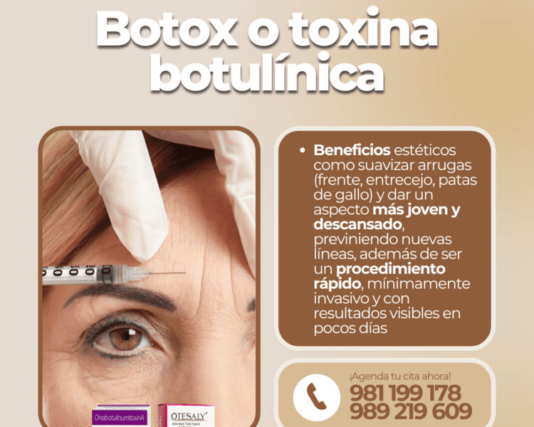 BOTOX FULL FACE