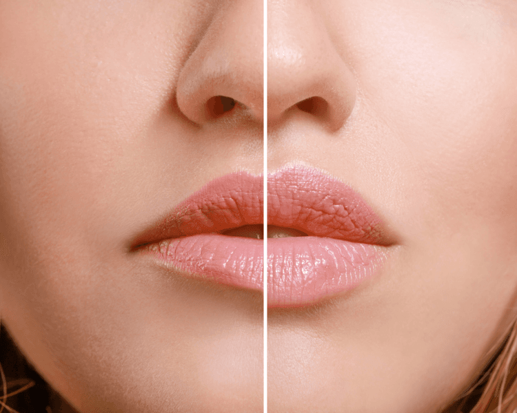 Hydralips · Hidratación y Volumen Natural