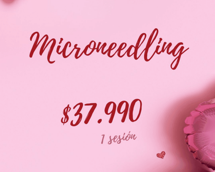 Microneedling facial - San Valentín 2026