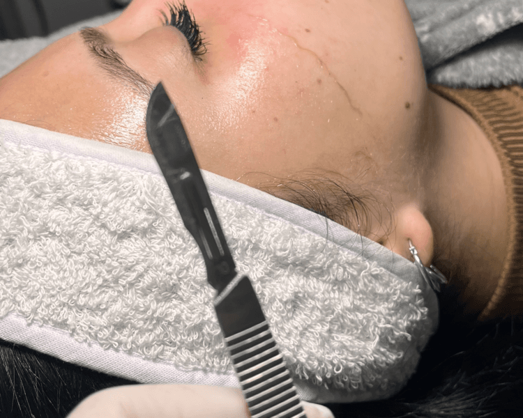 DERMAPLANING + Limpieza facial