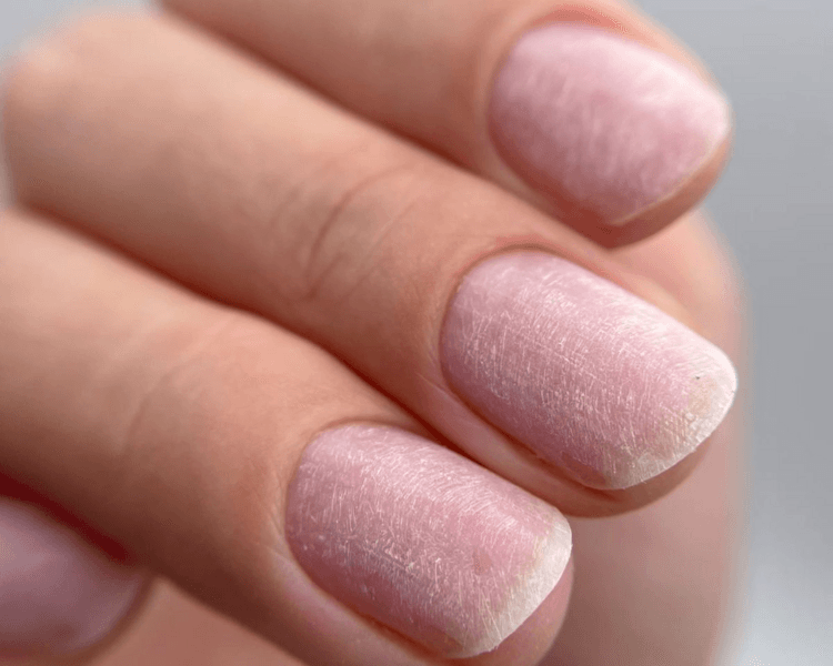 Retirado definitivo o retirado de otro local