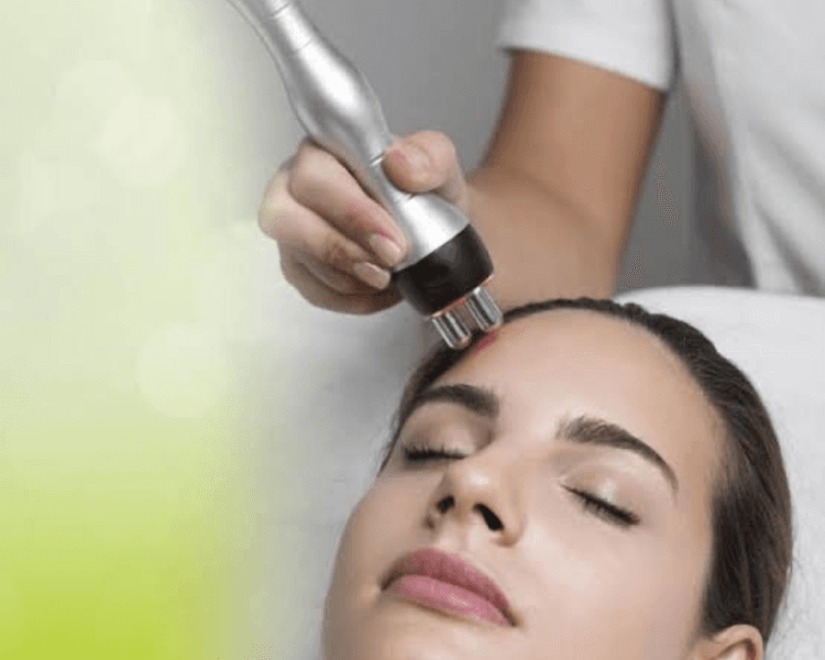 radiofrecuencia facial