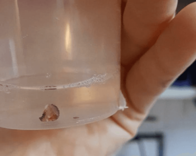 Biopsia ginecológica