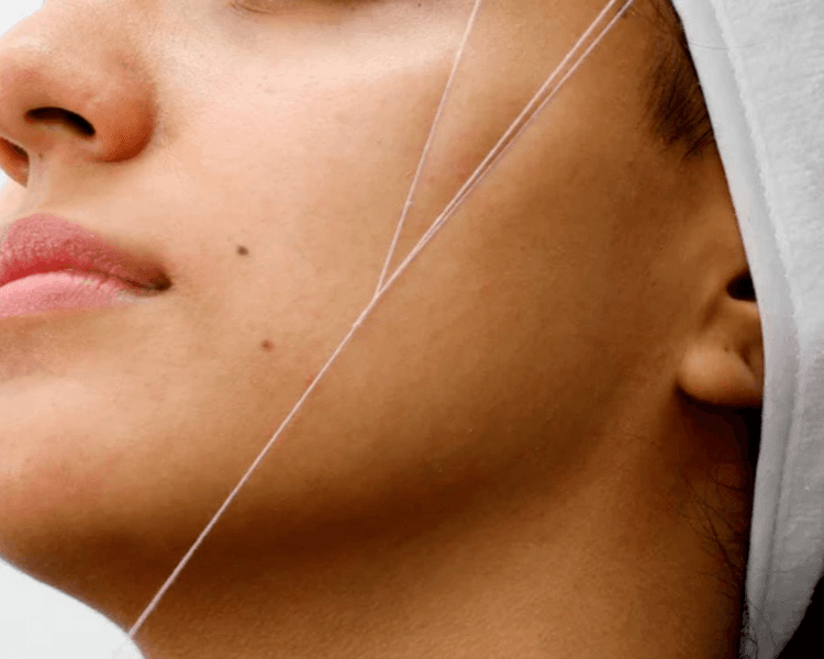 Depilación de Mejillas