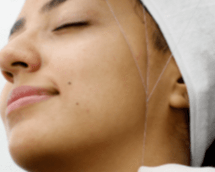 Depilación de Patillas