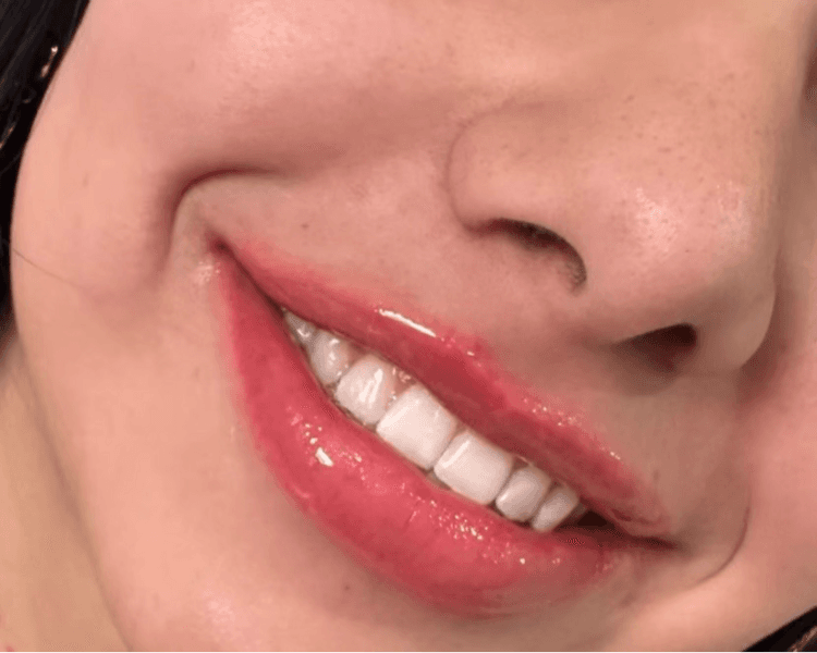 BB LIPS HIDRATACIÓN