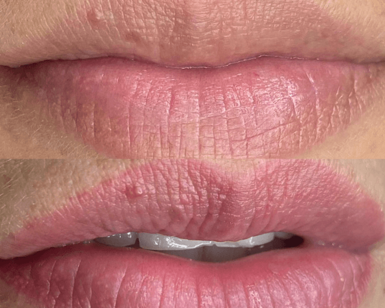 Micropigmentación de labios