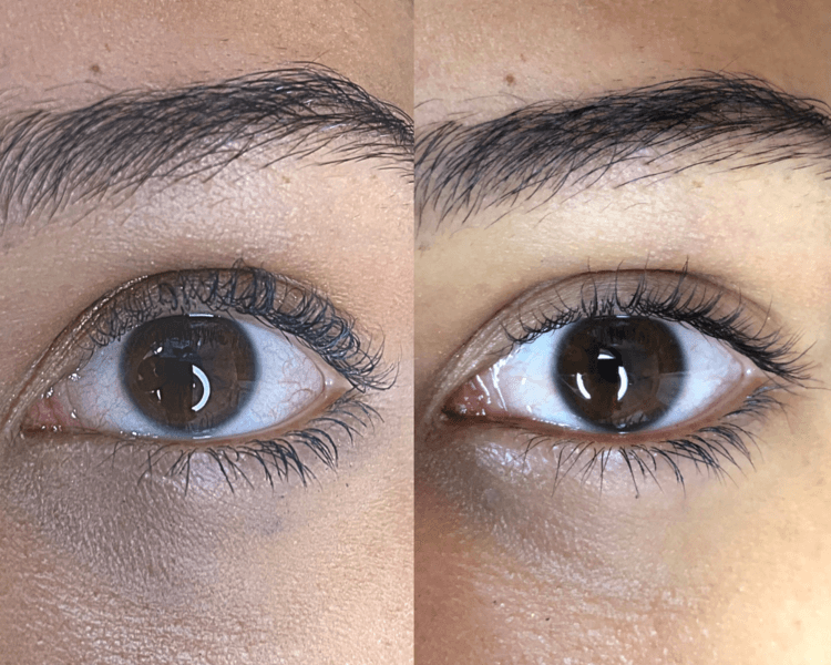 Revertimiento de lifting de pestañas