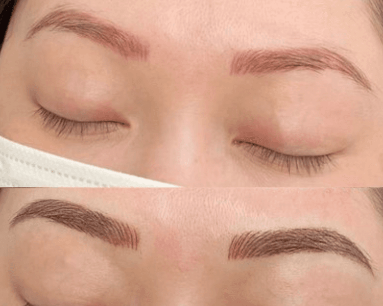 Neutralización de cejas