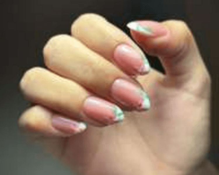 Capping Diseño Completo