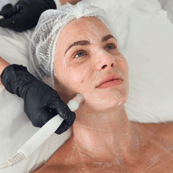 LIMPIEZA+BABY FACE+MICRONEEDLING (RADIOFRECUENCIA+DERMAPEN)(ROSTRO)