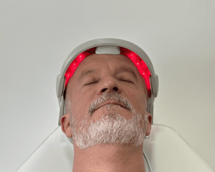 MESOTERAPIA CAPILAR 12 SESIONES