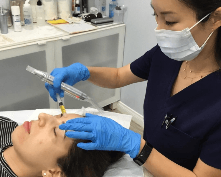 plasma rico en plaquetas rostro y cuello