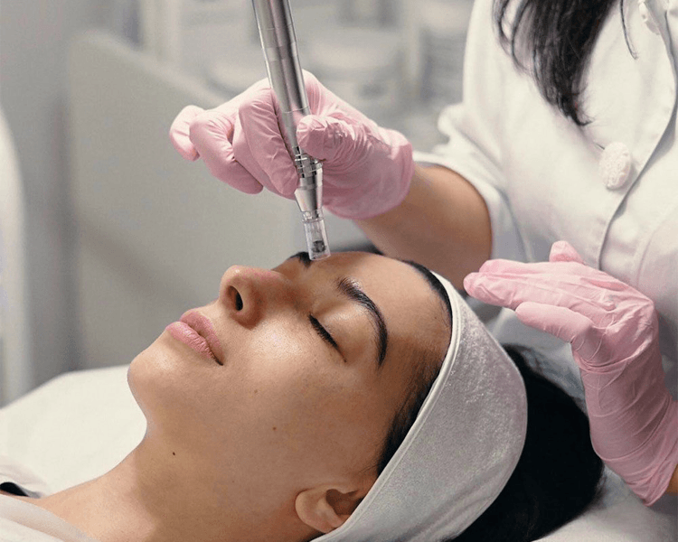 plasma rico en plaquetas rostro y cuello