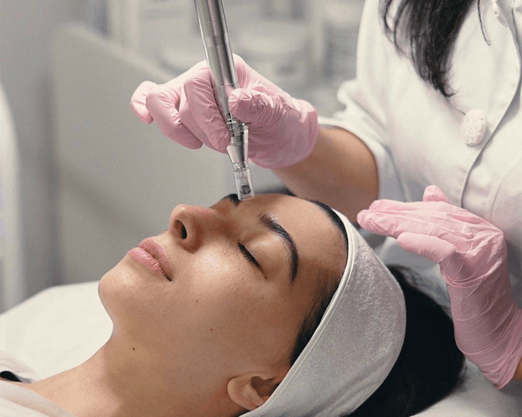 plasma rico en plaquetas rostro y cuello