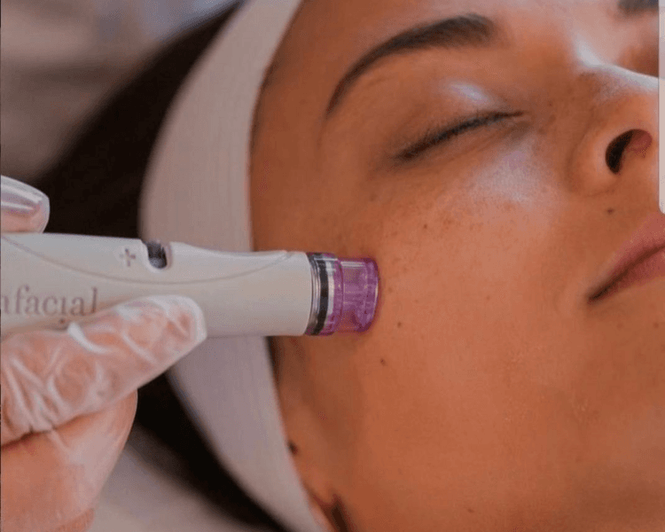 Limpieza facial profunda + Punta de diamante
