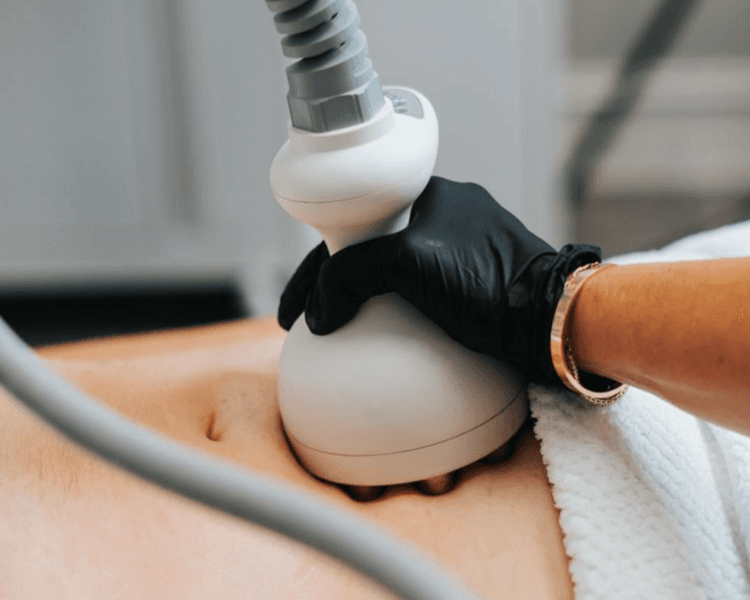 Crioradiofrecuencia/Radiofrecuencia corporal