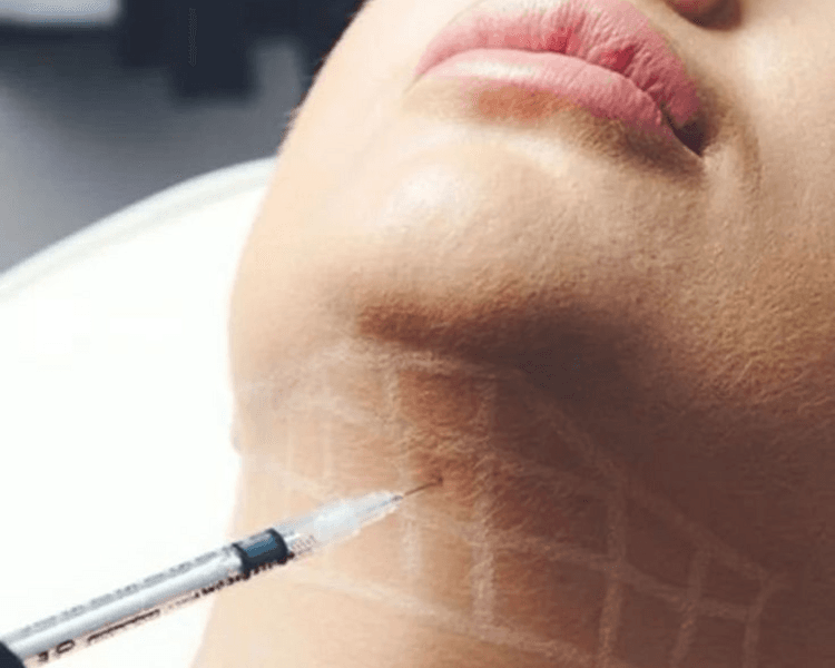 Lipopapada enzimatica 4 sesiones