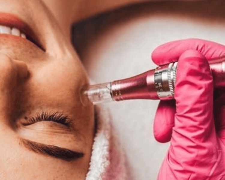 Exosomas (Lacto exo colla)