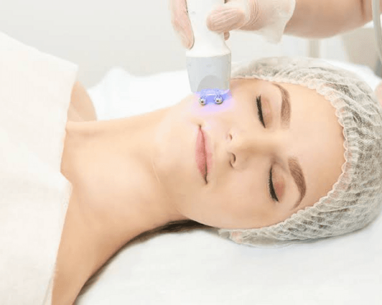 Radiofrecuencia facial