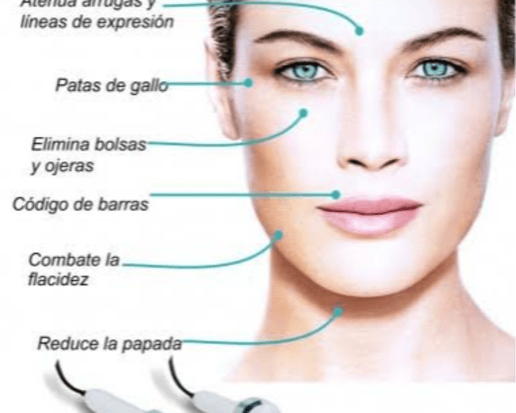 Ultrasonido + Radiofrecuencia facial
