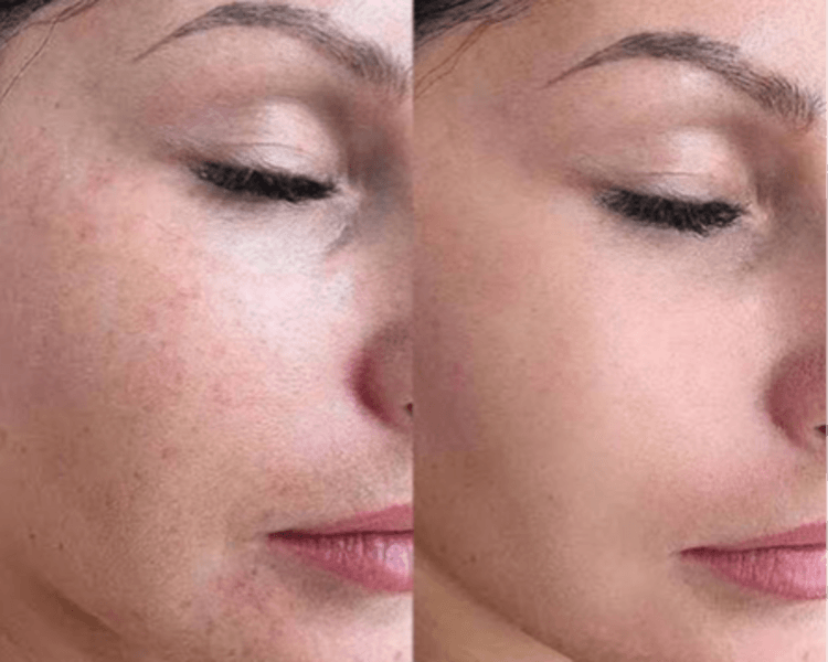 BB Glow piel de porcelana