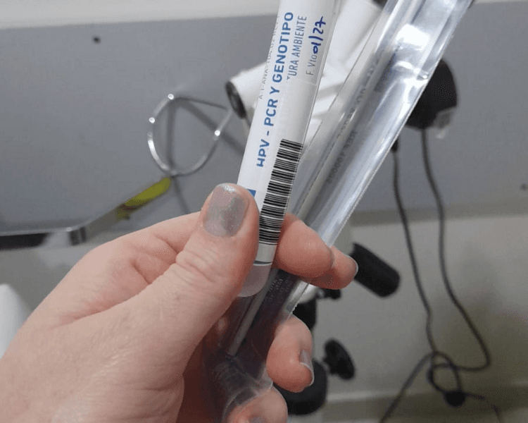 TEST HPV- PCR