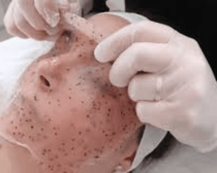 limpieza facial profunda + Jelly mask