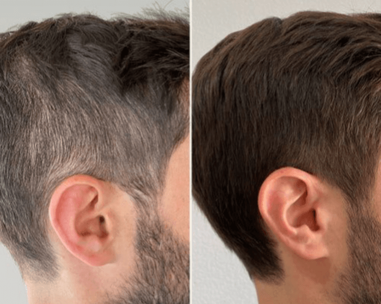 Camuflaje p/Canas (Shampoo)