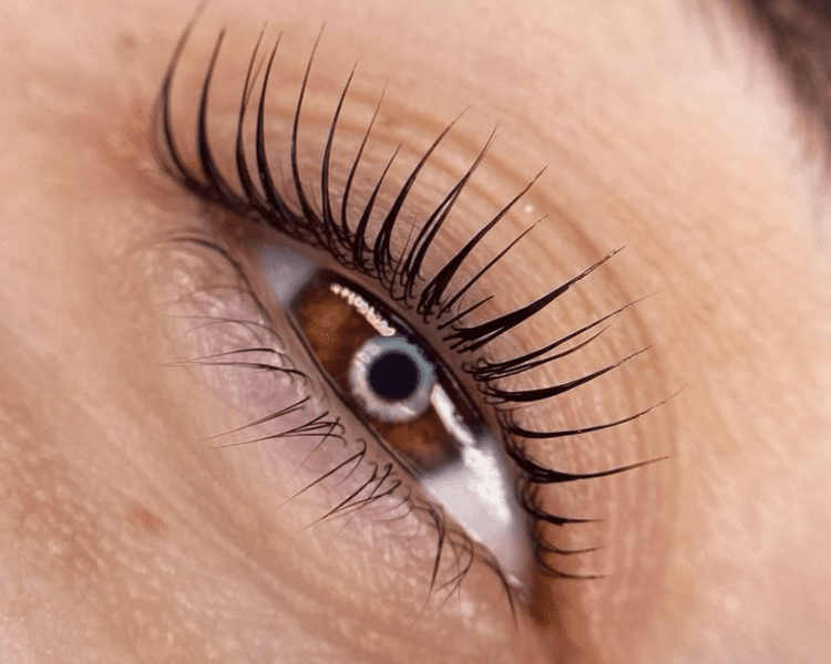 Retoque de liffting (tradicional)