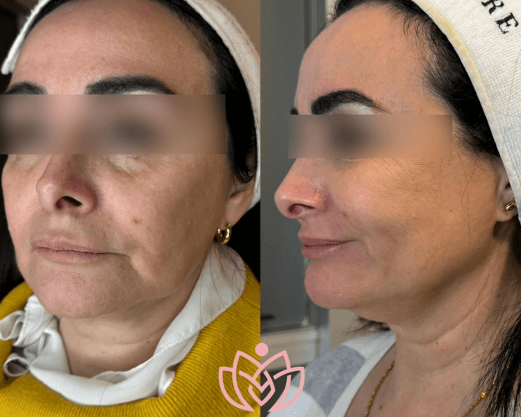 Relleno de Marionetas