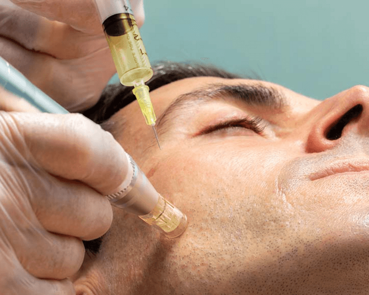 Dermapen + EXOMAS (Anti Age, Lift)