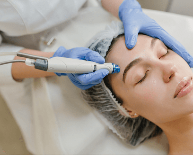 NUEVO! Dermapen + Ac Hialurónico - Clientas -