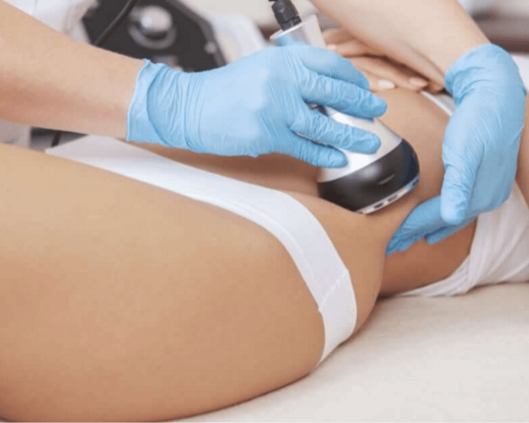 Sesión individual tratamiento corporal según diagnóstico y zona con aparatología estética: Cavitación, vacun, Radiofrecuencia, Ondas Rusas, entre otras