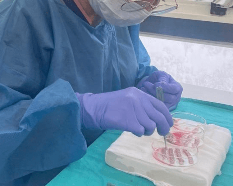 🧑🏻⚕️Implante Capilar – Técnica FUE 🧬