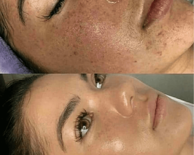 BB Glow (Maquillaje semipermanente)