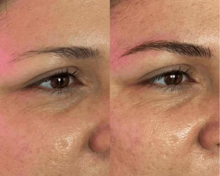 Microblading en cejas - 1ra sesión (3 cuotas sin interés)