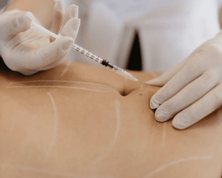 ✨ Adiposidad Localizada Funcional-BA (Remodelado Corporal)