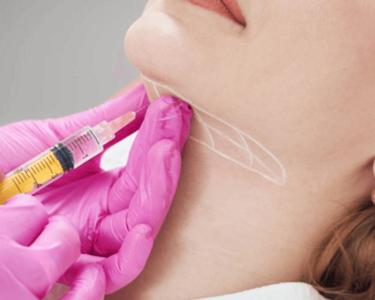 ✨ Adiposidad Localizada Funcional-BA (Remodelado Corporal)