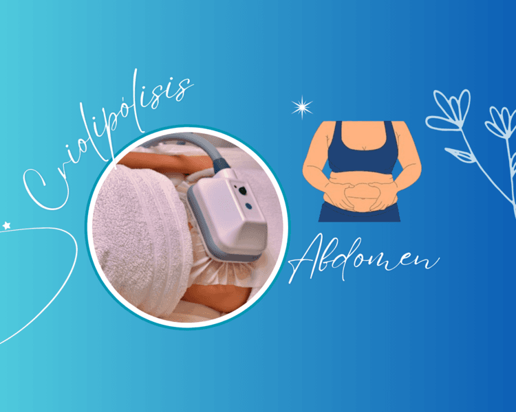 CRIOLIPÓLISIS ABDOMEN 🧊