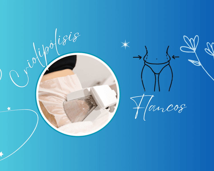 CRIOLIPÓLISIS FLANCOS🧊