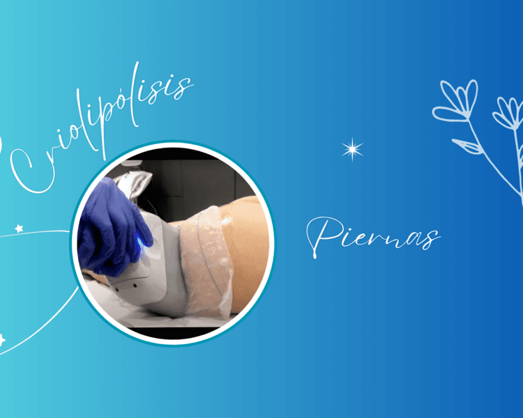 CRIOLIPÓLISIS PIERNAS 🧊