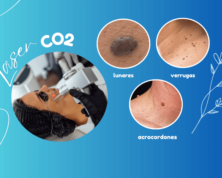 LÁSER CO2 FRACCIONADO 🪄