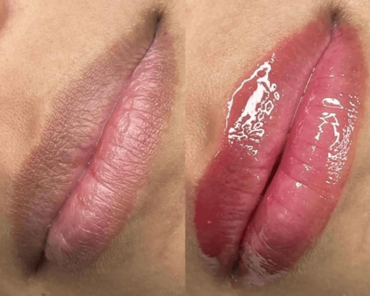 Hidratación profunda de labios