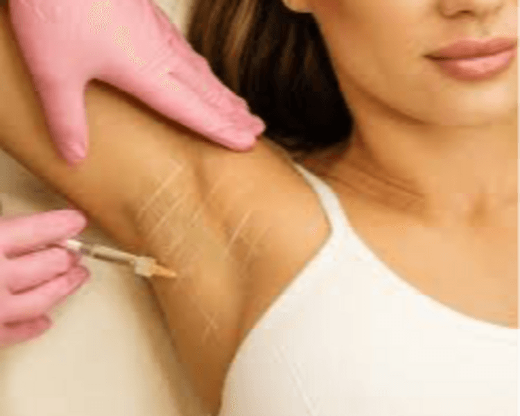Botox en contra sudoración excesiva / Botox for anti-sweat treatment