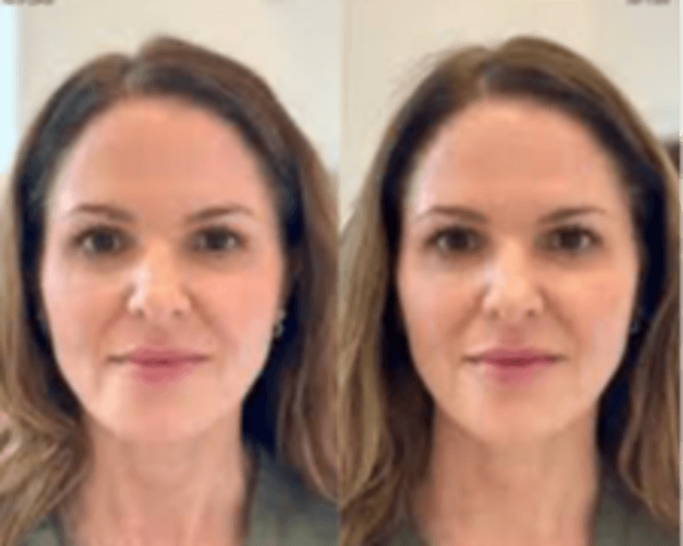 Relleno de Región Temporal / Temporal Region Filler