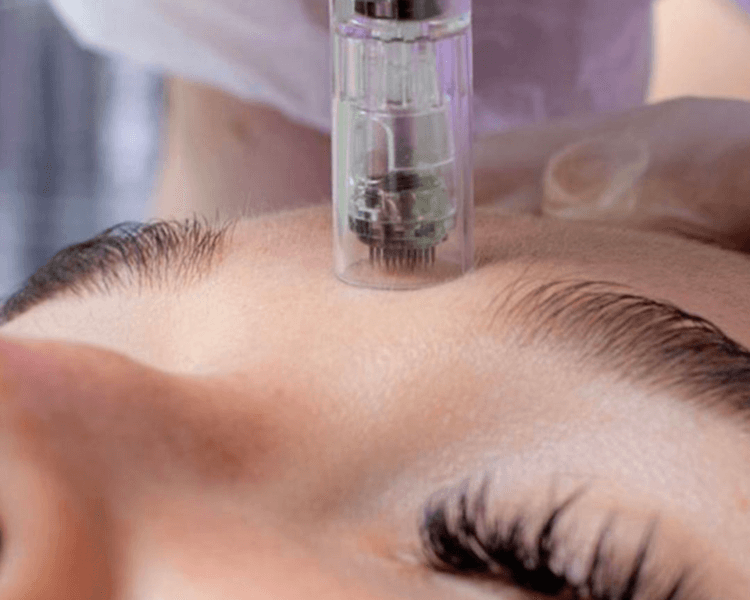 Microneedling hidratante/ regenerador - Hydrating/Regenerative Microneedling session